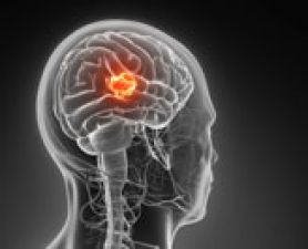 . Expanding the horizons of brain cancer research