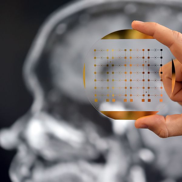 Phenotype Analyzer Chip. ‘Window to the brain’ opened with powerful cancer tech.