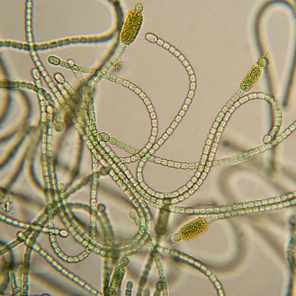 microscopic shot of cyanobacteria or blue-green algae resembling worms. Scientists unlock key to breeding ‘carbon gobbling’ plants with a major appetite