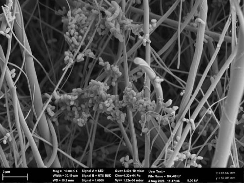 Black and white close up of microbacterium