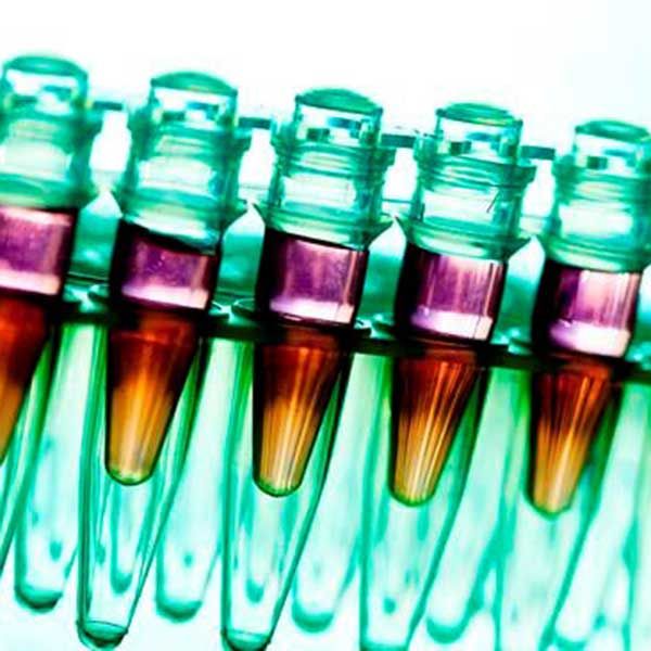 A row of test tubes filled with dark liquid