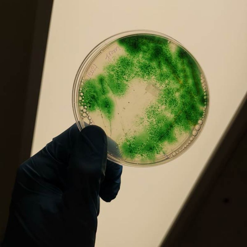 Person with lab gloves holding a Cyanobacterial Bloom Plate up to a light
