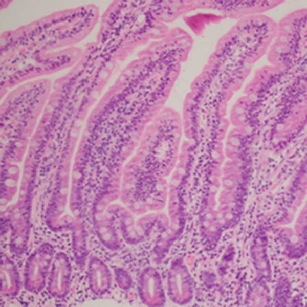 . Think you’re gluten intolerant? Perhaps think again