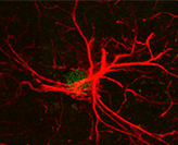 Stroke Discovery. Stroke discovery.