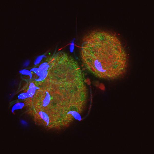 microscopic image of sperm brightly coloured against a black background