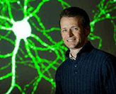 Associate Professor Murray Cairns. Schizophrenia research first.