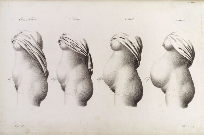 A historic drawing of 4 stages of the body during pregnancy 
