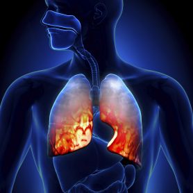 Asthma discovery. Respiratory disease breakthrough
