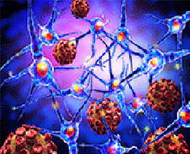 MS research. MS researchers to explore environmental triggers