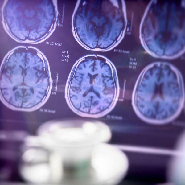 NHMRC Ideas grants 2021. $4.5m in NHMRC Ideas Grants supports quest to improve human health