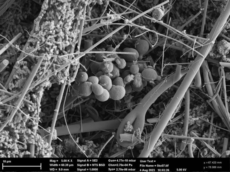 Black and white close up of Microbacterium