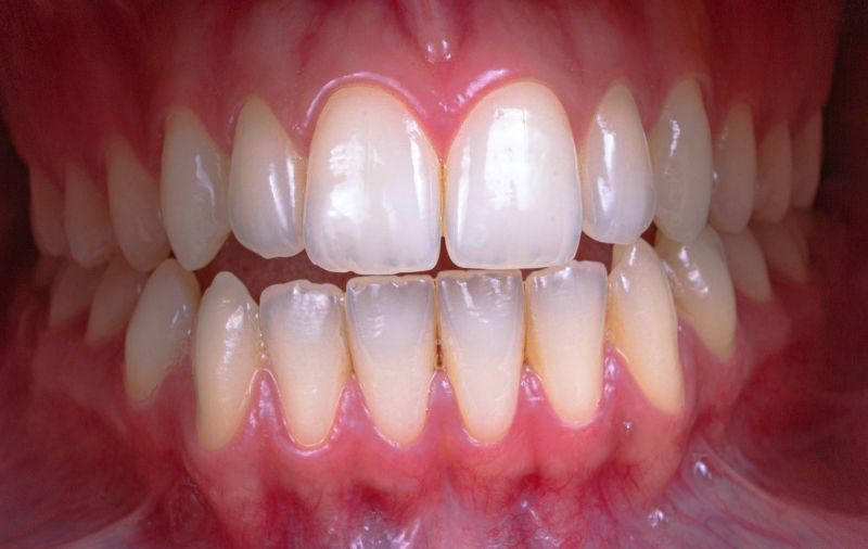 Close up a persons teeth