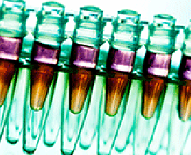 Prostate cancer breakthrough widget. Prostate cancer breakthrough