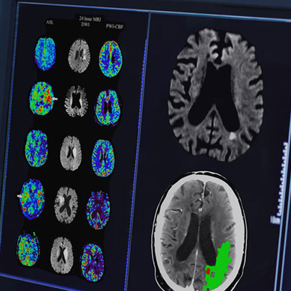 Engagement and impact toolkit