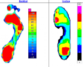 Footprint Pressure. Foot Pressure Study