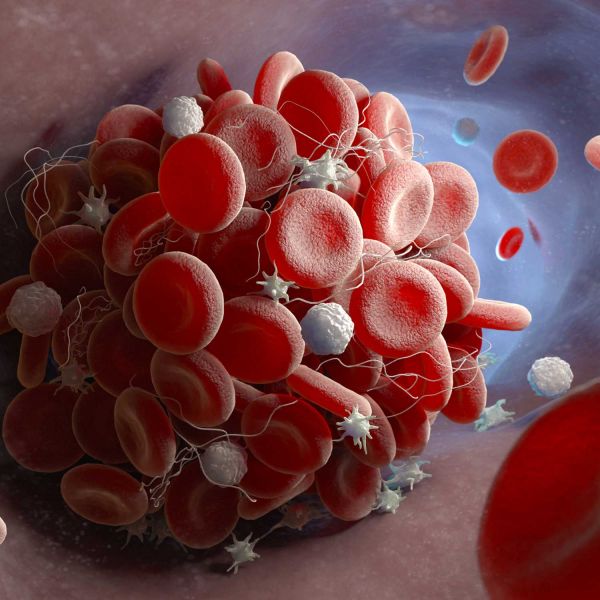 Surgical researchers receive funding boost for blood clot prevention trial 